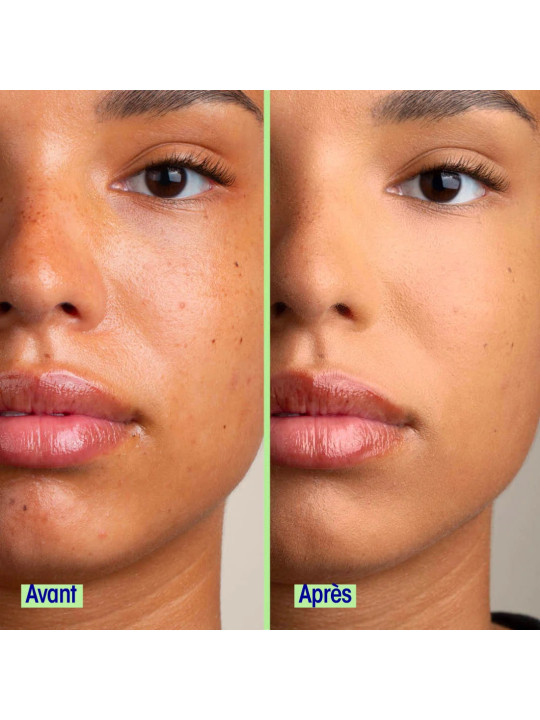 BB Cream 30ml 03 Medium