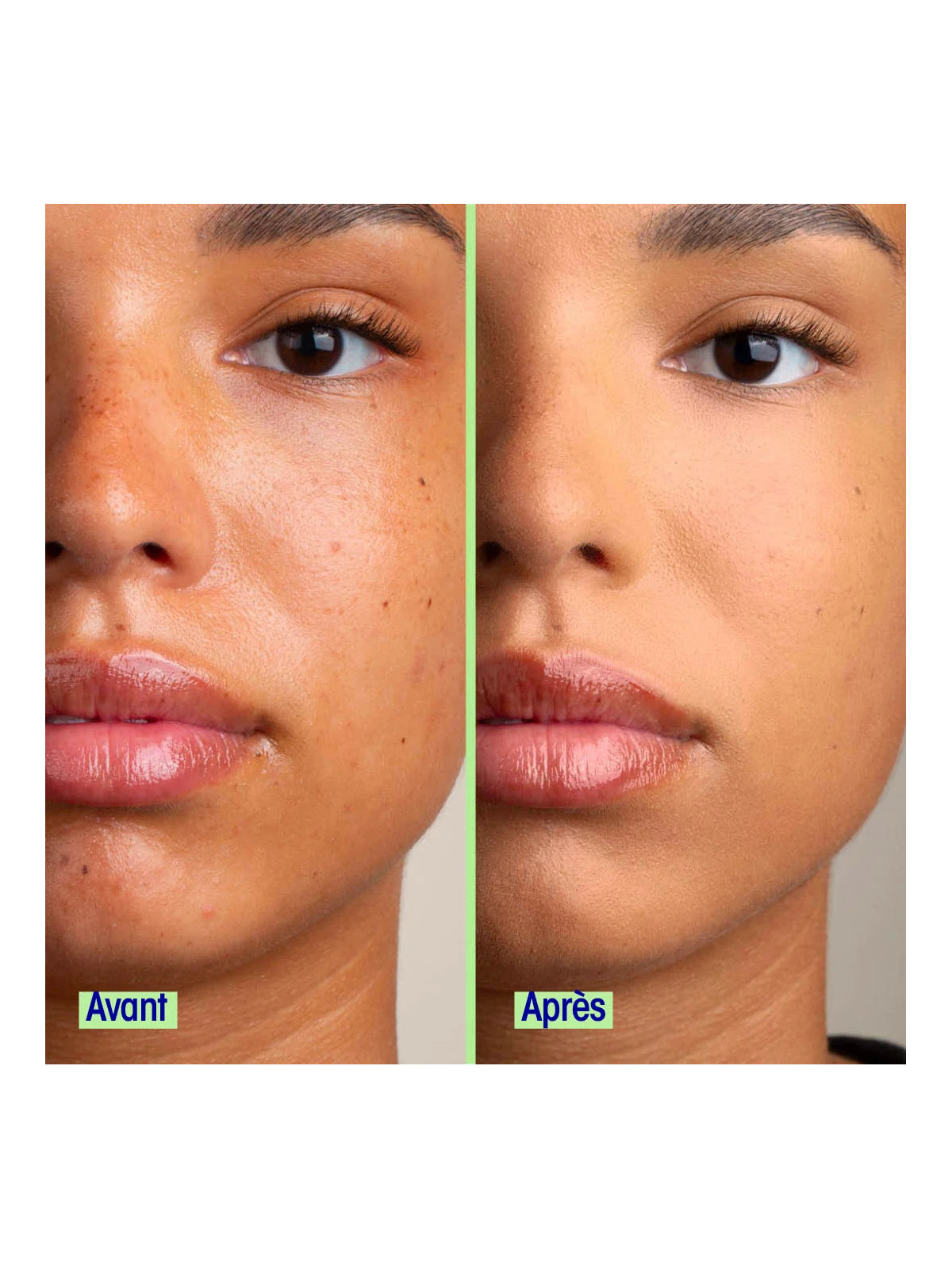 BB Cream 30ml 03 Medium