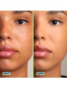 Mattifying BB Cream 30ml Shade 03 Medium
